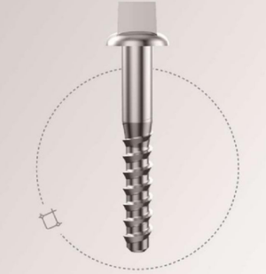 rail fastening rail fastening